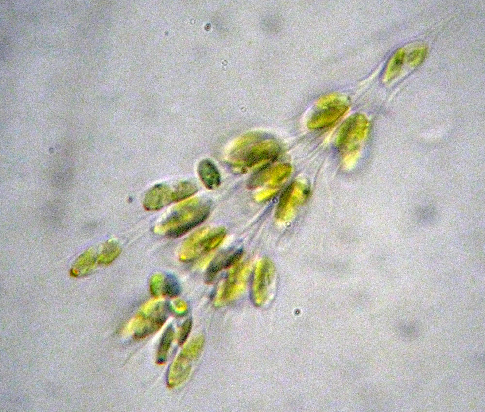 Dinobryon forse sertularia